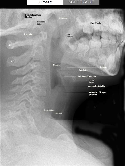 which test is good for visualizing soft tissues|Radiological anatomy: X.